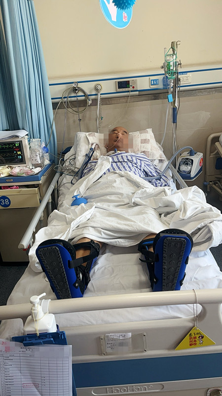 脑梗患者
